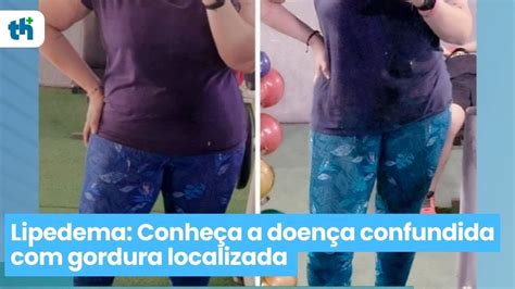 Conheça a prostituta confundida com a primeira